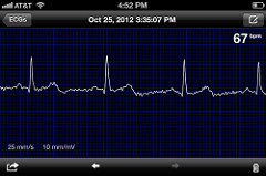 Monitor de corazón
