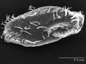 Ciliar