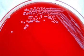 bacteriascolonies1