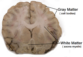 Sección transversal de un cerebro humano.