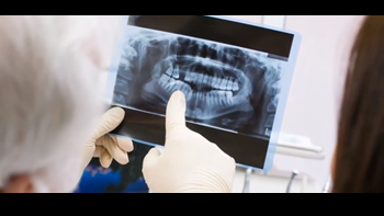 radiografia dental