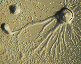Dictyostelium