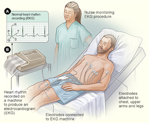 Electrocardiograma