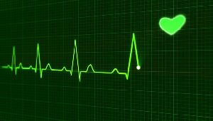 Imagen de una lectura de monitor de EKG