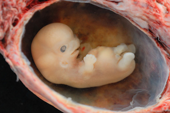 Embrión humano a las 6-7 semanas