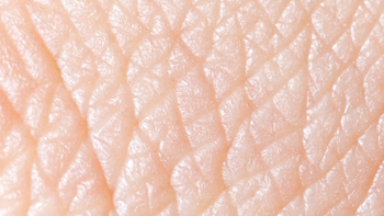 epidermis