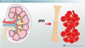 Anemia por eritropoyetina