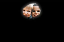 retinitis pigmentosa