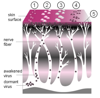Diagrama de culebrilla