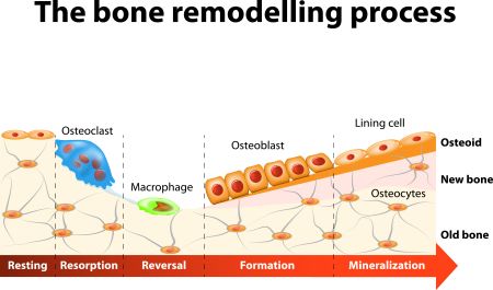 osteoclasto