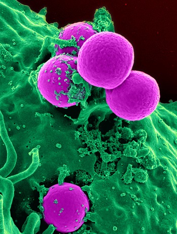 neutrófilos y mrsa