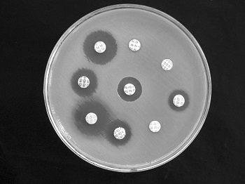 susceptibilidad a los antibióticos