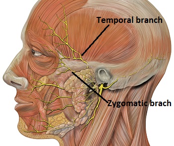 nervio facial