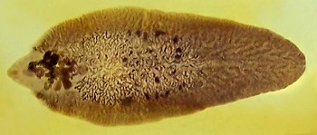 fasciola hepatica