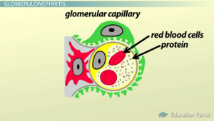 Capilar glomerular
