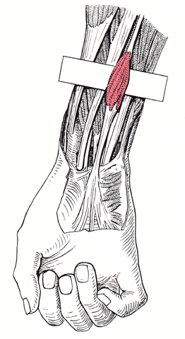 Palmaris Longus