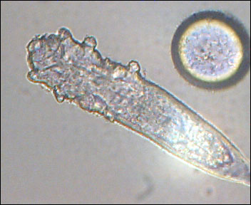 Un ácaro demodex