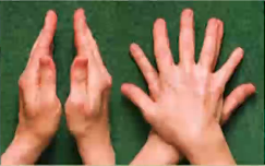 Manos