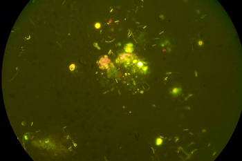Bacterias en muestra de agua