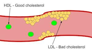 HDL frente a LDL