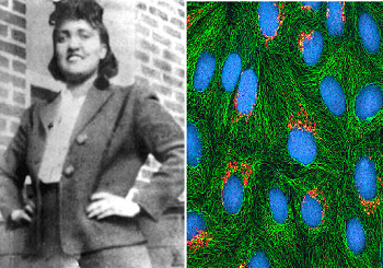 Henrietta Lacks y HeLa Cells