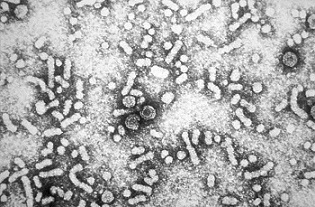 Imagen del virus de la hepatitis B