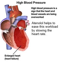 El atenolol disminuye la carga de trabajo del corazón al disminuir la frecuencia cardíaca y bajar la presión arterial.