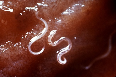 Dos pequeños gusanos se adhieren a la pared intestinal