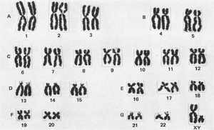 Cromosomas homólogos después de la replicación