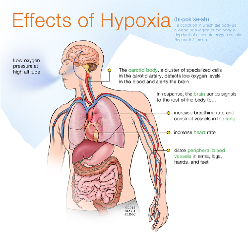 Diagrama que muestra los síntomas de la hipoxia.