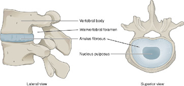 Disco espinal
