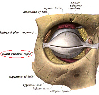 rafe palpebral lateral