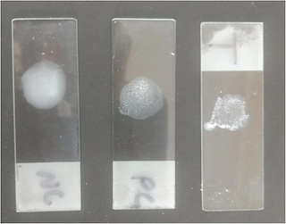 Prueba de aglutinación de látex