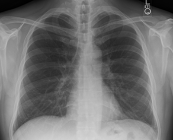 Radiografía médica