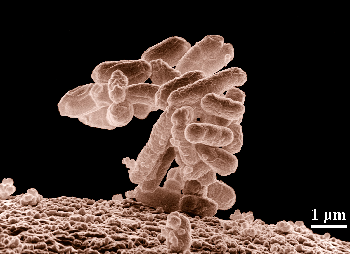 Imagen de una micrografía de un microorganismo.