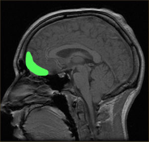 la corteza prefrontal