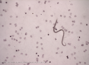 Imagen del movimiento de los nematodos