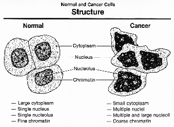 Diagrama que compara células normales y cancerosas