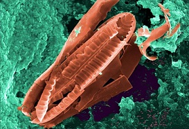 Microorganismo que necesita ser descontaminado.