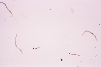 gusanos