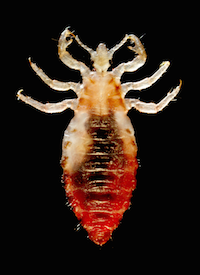piojo de la cabeza humana 