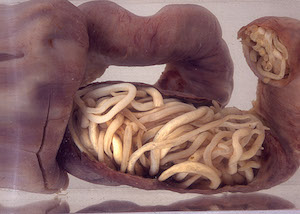 lombriz intestinal