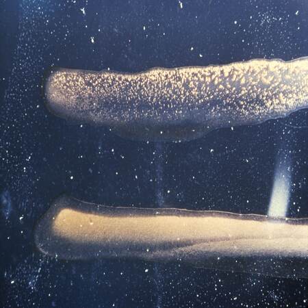 Aglutinación bacteriana
