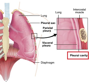 cavidad pleural