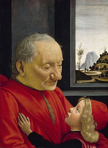 Un hombre con rinofima