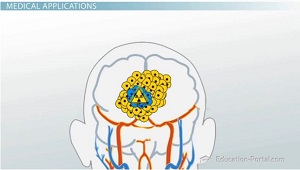 Isótopos radiactivos de radioterapia
