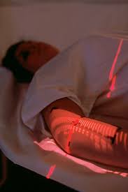 radioterapia