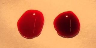 glóbulos rojos y contenido de oxígeno