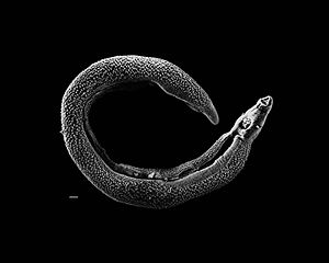 Un parásito de la sangre, conocido por causar esquistosomiasis.