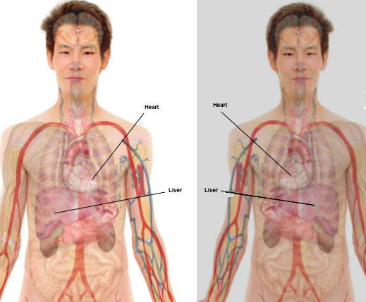 Situ inversus